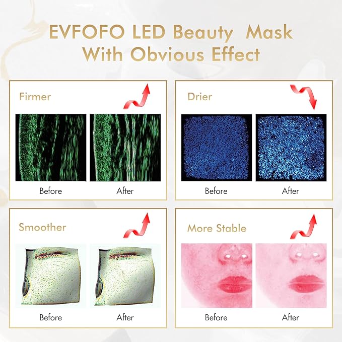 LED Face Mask Light Therapy