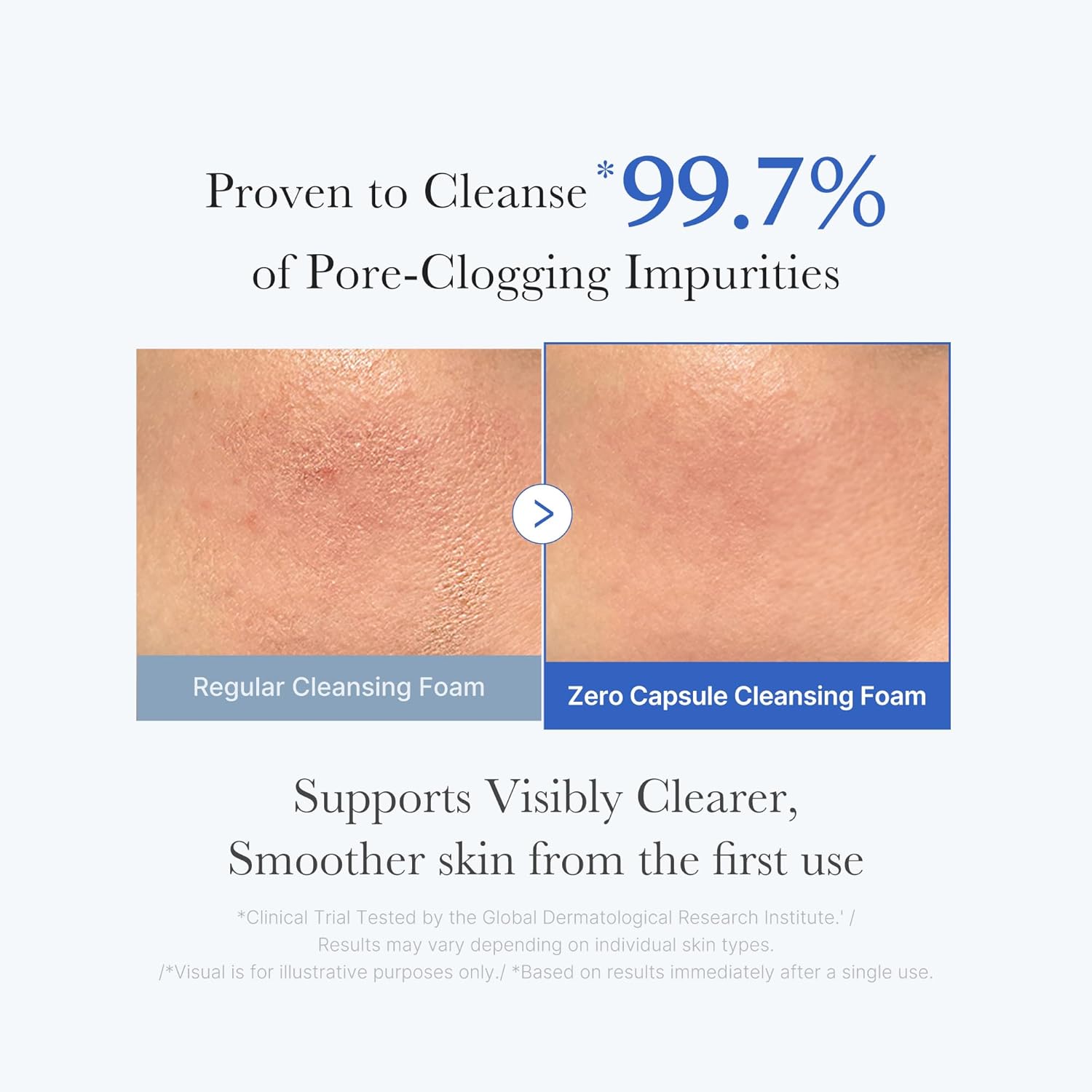 Daily Gentle Cleanser for Skin Texture